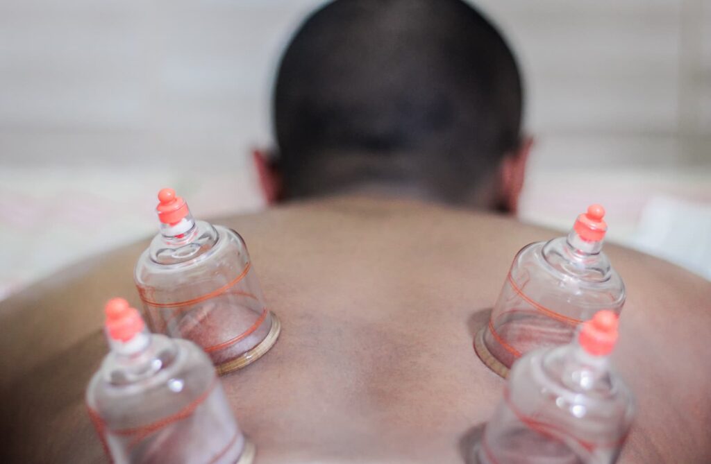 Young man receiving cupping treatment.